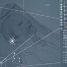 L'histoire au scalpel : Napoléon à Sainte-Hélène - Le dernier acte documentaire historique FRANCE 5